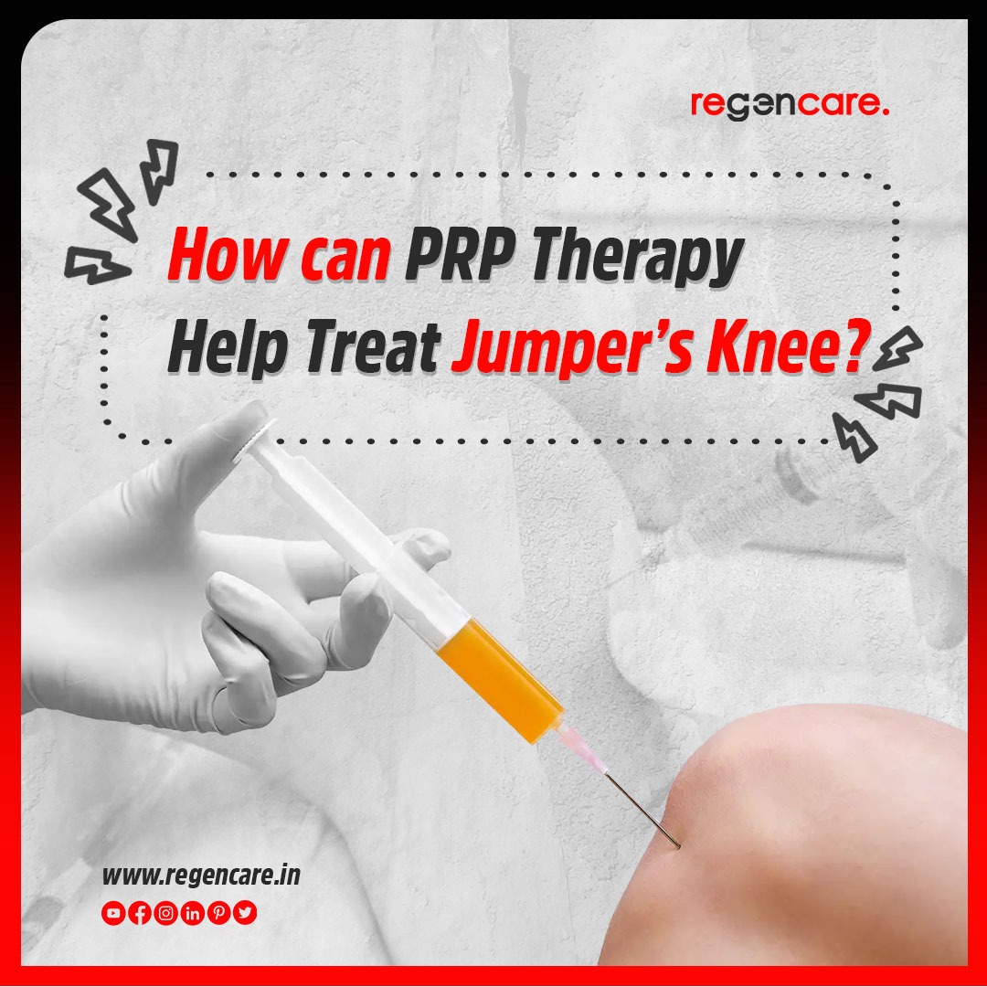 How can PRP therapy help treat jumper's knee? - Regencare