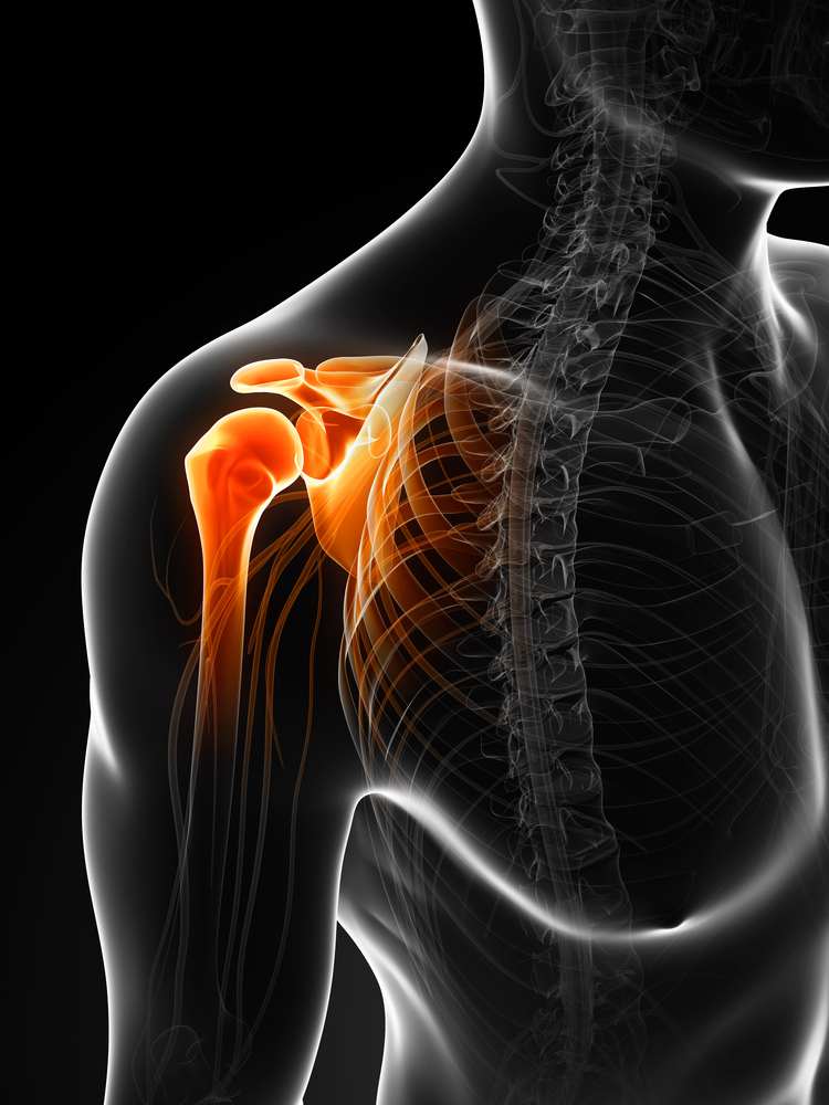 PRP treatment for frozen shoulder in Kochi - Regencare