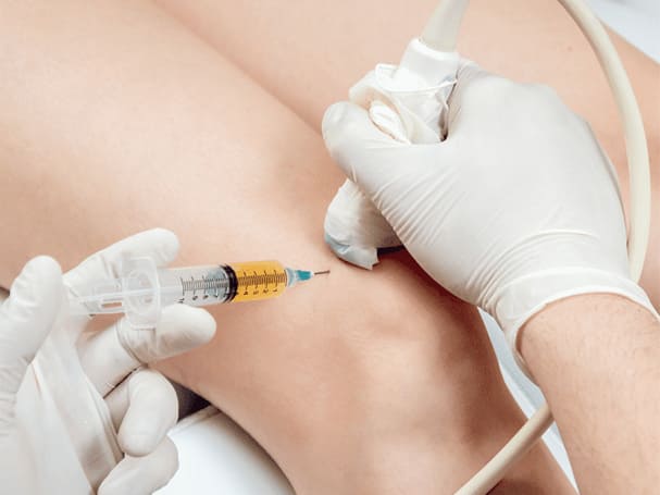prp injection for orthopedic condition